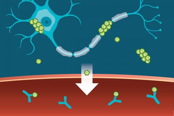 Toxins Linked To Alzheimer's Disease Can Be Targeted With Computer-Designed Antibodies