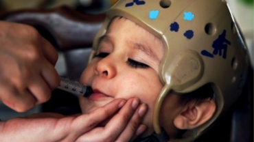 Children with Epilepsy and CBD Treatment